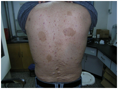 17bdRozFuOE7Yutj.png image.png